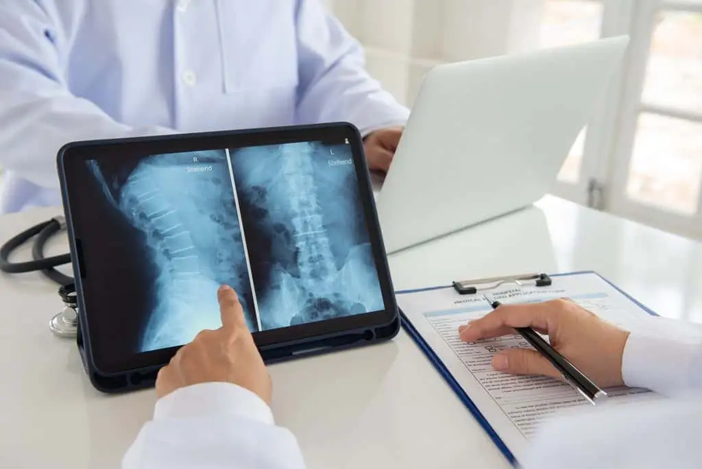 a doctor reviews an x-ray image of a car accident victims neck.